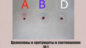 Определение группы крови цоликлонами-1.