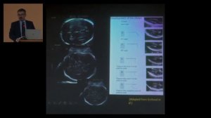 нормальное развитие головного мозга и пороки развития мозолистого тела