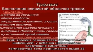 Трахеит у взрослых и детей. Признаки и симптомы