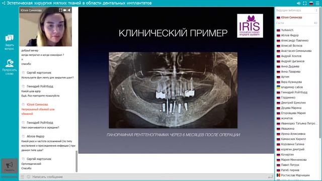 Вебинар "Эстетическая хирургия мягких тканей в области дентальных имплантатов" смотреть онлайн