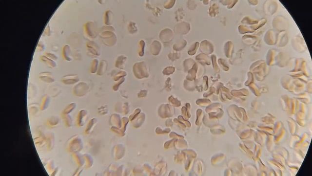 Кровь после мяса. Мега эксперимент смотреть онлайн