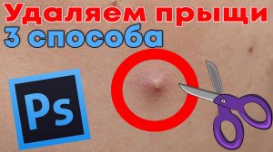 Как убрать прыщи в фотошопе -  3 способа
