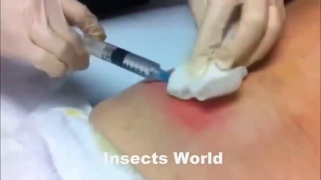 Огромный опарыш смотреть онлайн