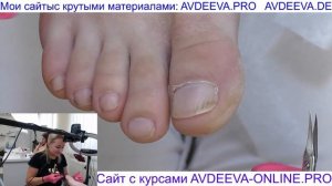 ПЕДИКЮР. СЛОЖНЫЕ НОГИ. Виктория Авдеева