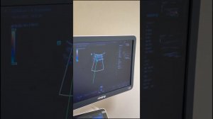 Сделать УЗИ сосудов шеи
