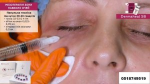 Dermaheal SB