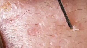 Enjoy Every Day With The Best Video Loan Nguyen Spa New Office #Spa095