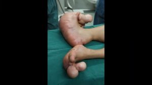 Топ самые страшные болезни мира