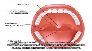 Все о небных миндалинах