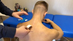 Наложение кинезил тейпа при болях в шейном отделе позвоночника.