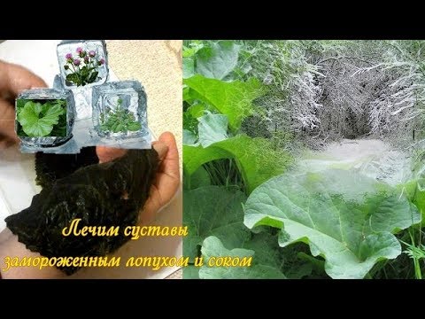 КАК Я ЛЕЧУ СУСТАВЫ ЗАМОРОЖЕННЫМ ЛОПУХОМ И СОКОМ В ЗИМНИЙ ПЕРИОД ОБОСТРЕНИЯ.