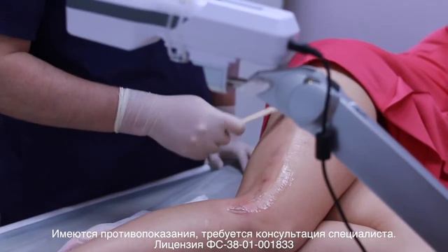Удаление сосудистых звездочек смотреть онлайн