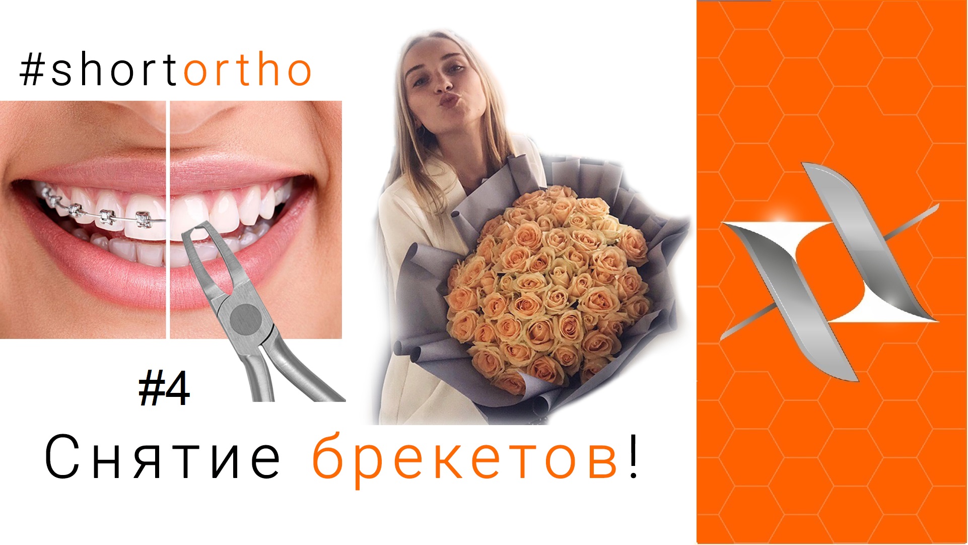 Эго плюс. Реклама брекетов your Clinic с lays.