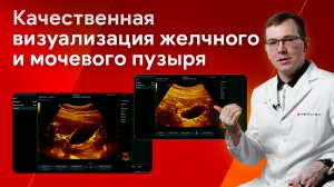 Оптимизация изображения на УЗИ желчного и мочевого пузыря