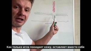 Как работает микрониллинг: сыворотка под кожу | Подписывайтесь на канал для успешных косметологов!