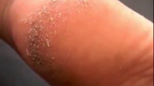 Кислотный педикюр