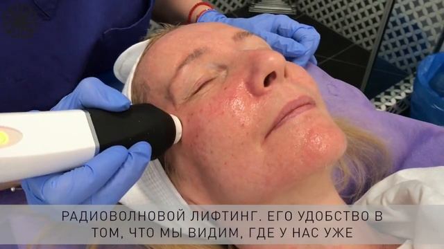 Омоложение кожи на аппарате Geneo+ смотреть онлайн