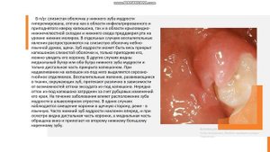 "Болезни прорезывания зубов. Перикоронит" онлайн урок