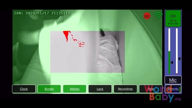 The SAMi-3 Seizure Monitor: How It Works смотреть онлайн