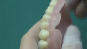 Съемные протезы из акрила