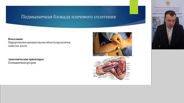 Регионарная анестезия