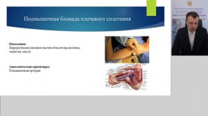 Регионарная анестезия