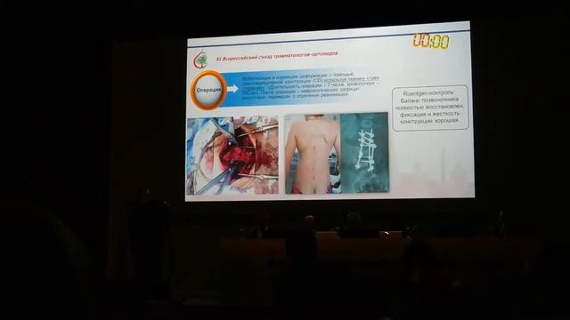 СЕКЦИЯ ХИРУРГИЧЕСКАЯ ВЕРТЕБРОЛОГИЯ, XI ВСЕРОССИЙСКИЙ СЪЕЗД ТРАВМАТОЛОГОВ - ОРТОПЕДОВ смотреть онлайн