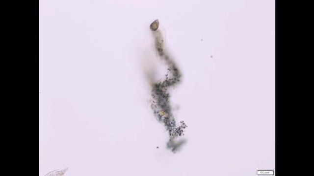 А вы знаете, как выглядит живая амёба под микроскопом? смотреть онлайн