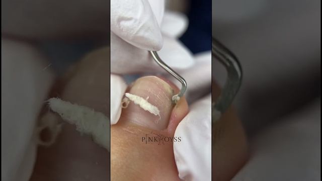 Пена для педикюра/ масло для ногтей и кожи #педикюр #очищениекожи #skincare #pedicure #pedicura