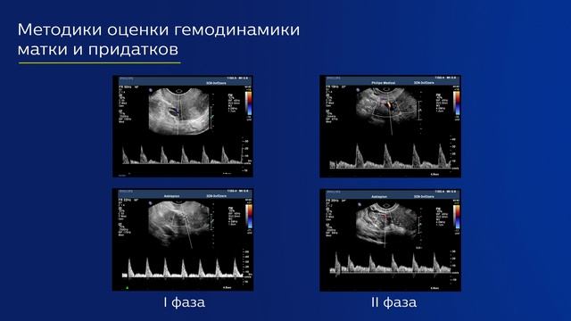 Лекция 2.2 | Ультразвуковая оценка васкуляризации органов малого таза | Ирина Озерская | Лекториум