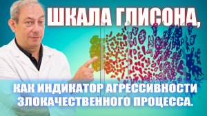 Шкала Глисона, как индикатор агрессивности злокачественного процесса #лечениеракапростаты#здоровье