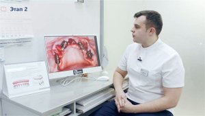 Тотальное протезирование на 4х имплантатах