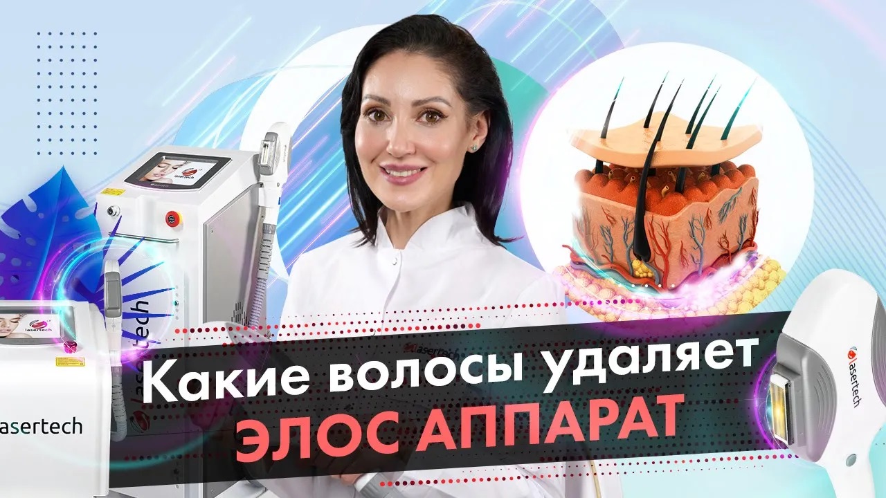 Какие волосы удаляет Элос аппарат? Элос эпиляция LASERTECH