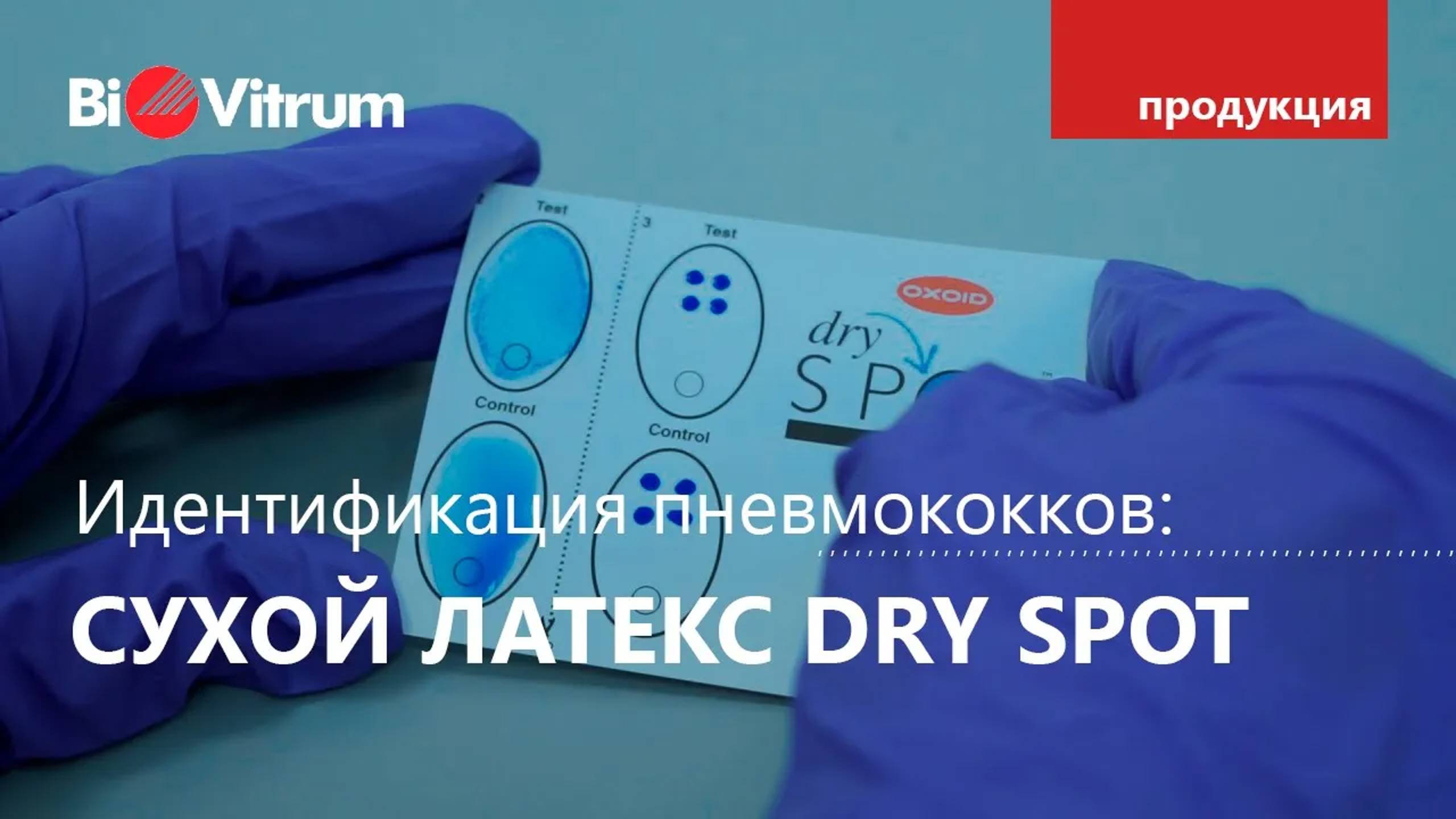 Идентификация пневмококков: наборы