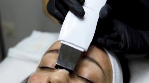 Ультразвуковая чистка лица