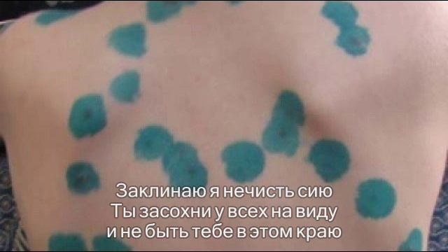 Гнойник