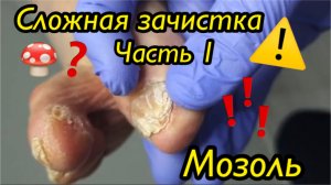 Сложная зачистка ногтей??⚠️??? • Мозоль? • Часть 1
