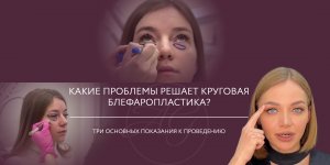 Кому показана круговая блефаропластика? Три основных показания