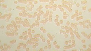 Состояние крови после употребления растительного сыра по собственной технологии