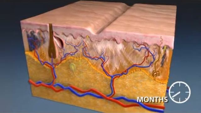 Фракционное омоложение кожи на аппарате SmartXide DOT! в Премьер Салоне смотреть онлайн