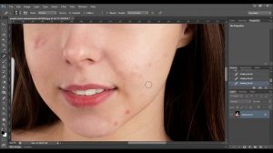 Tutorial Photoshop CS6 Hilangkan Jerawat Untuk Pemula 2022