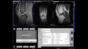 Knee MRI positioning