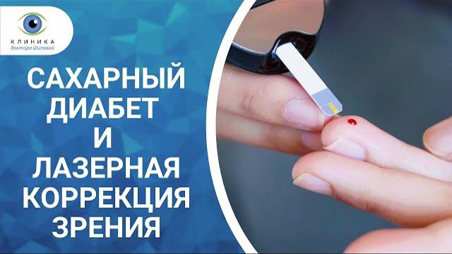 Сахарный диабет и лазерная коррекция зрения - можно ли делать операцию? смотреть онлайн