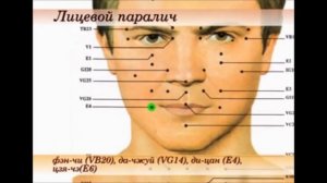 точки при невралгии тройничного нерва и лицевом параличе(секрет исюэтуна)