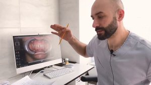 Гингивопластика