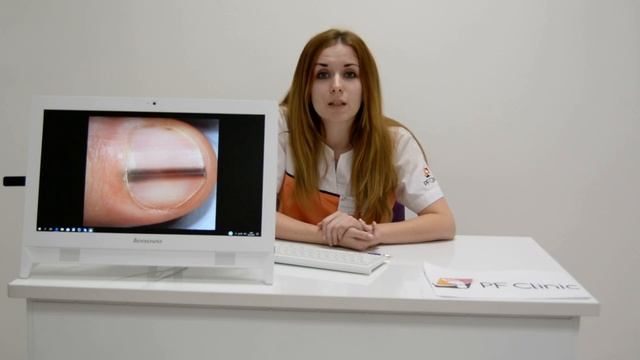 Меланонихия: пятна и полосы на ногтях. Очень опасно!!! смотреть онлайн