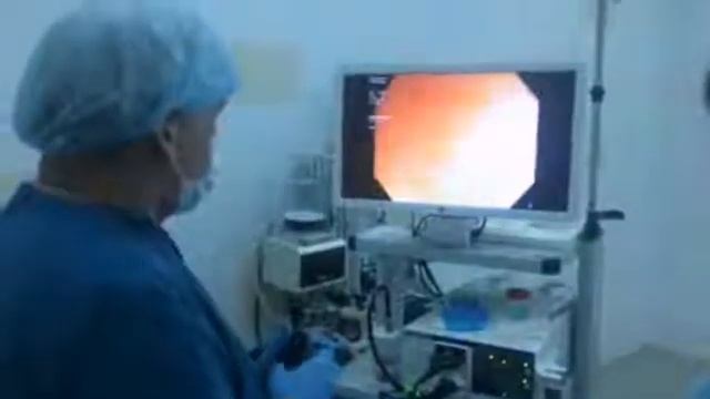 эндоскопическое исследование ЭГДС - эзофагогастродуоденоскопия