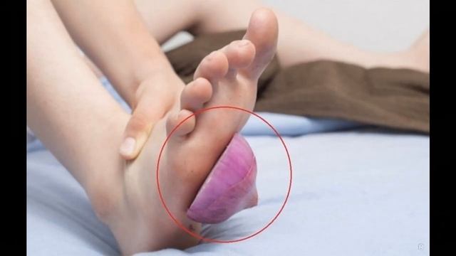 ЛУК ОТ НАСМОРКА КАШЛЯ ДЛЯ ВОЛОС И ДР смотреть онлайн