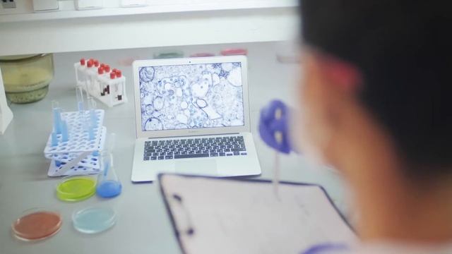 Прыщи на  попе: 10 ЭФФЕКТИВНЫХ СПОСОБОВ ИЗБАВИТЬСЯ ОТ ПРОБЛЕМЫ смотреть онлайн