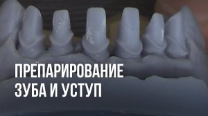 Плохой преп. Как правильное препарирование влияет на успех работы Препарирование зуба зубной техник